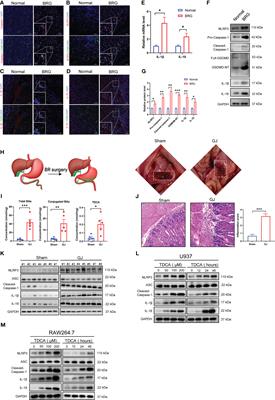 USP50 regulates NLRP3 inflammasome activation in duodenogastric reflux-induced gastric tumorigenesis